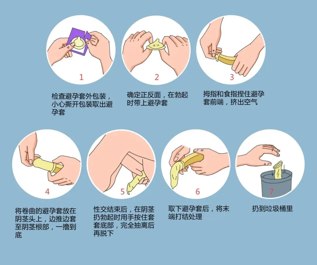 年輕人成艾滋病重災區(qū)，正確戴套很有必要.jpg